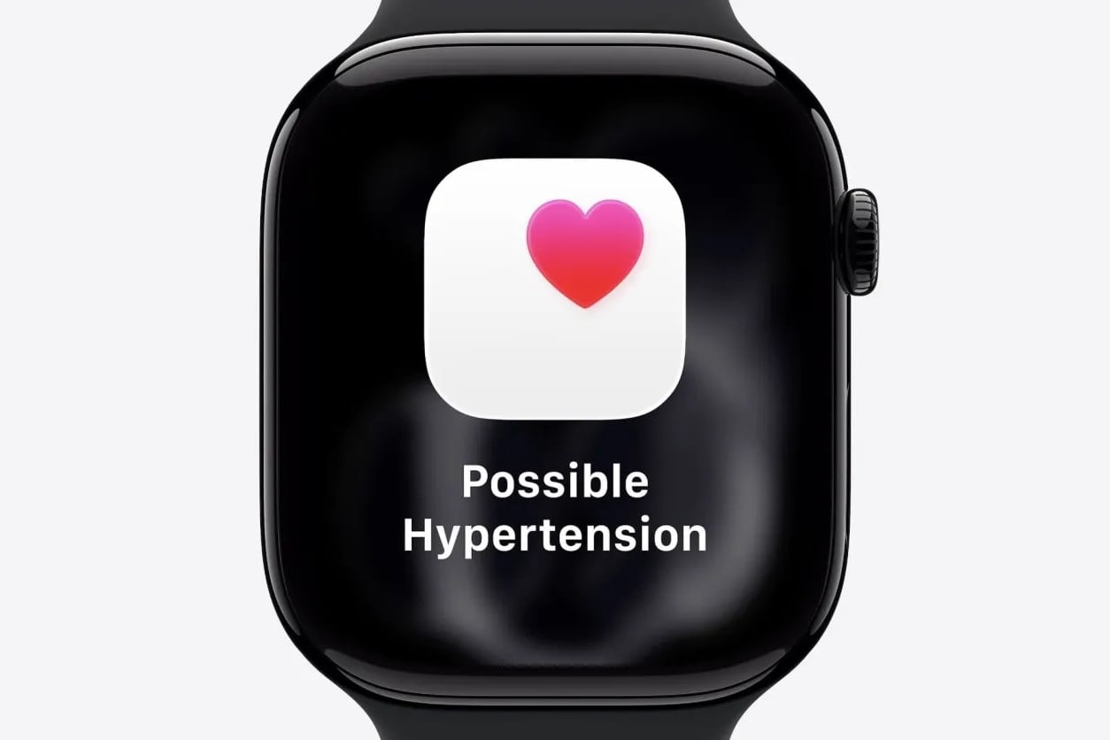 Новая функция оповещений о гипертензии в Apple Watch: одобрение от FDA